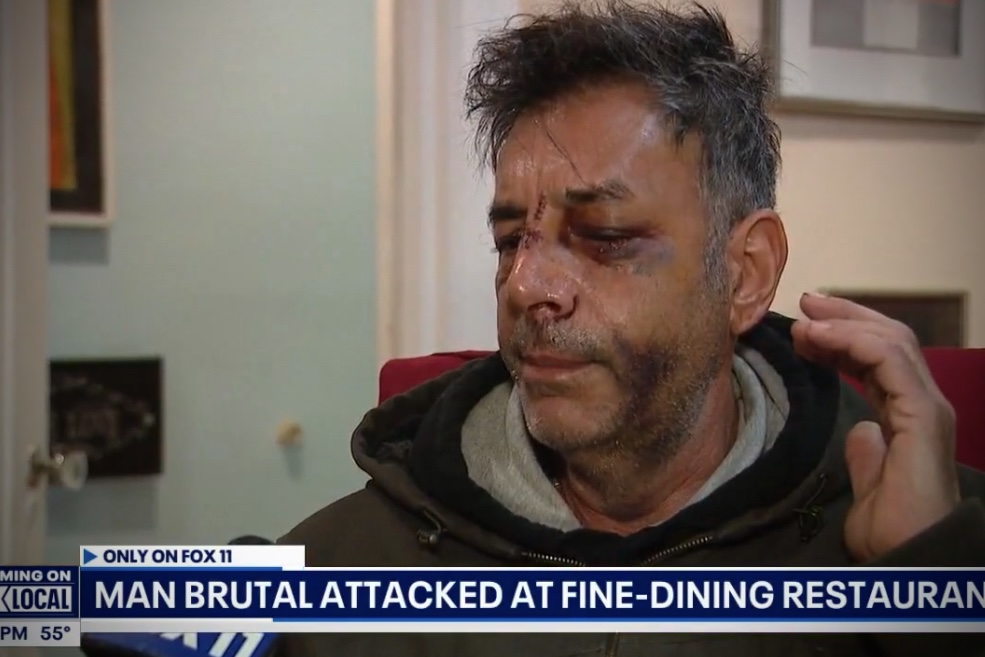 Fires, Fine Dining Assaults and the Unhoused – THIS WEEK IN CRIME – 2025 New Year Edition